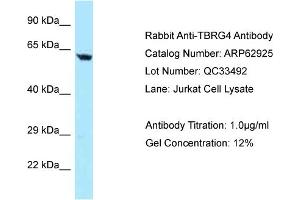 Western Blotting (WB) image for anti-Transforming Growth Factor beta Regulator 4 (TBRG4) (N-Term) antibody (ABIN2789299) (TBRG4 Antikörper  (N-Term))