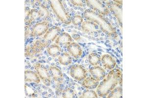 Immunohistochemistry (Paraffin-embedded Sections) (IHC (p)) image for anti-Alveolar Soft Part Sarcoma Chromosome Region, Candidate 1 (ASPSCR1) (AA 284-553) antibody (ABIN6137219)