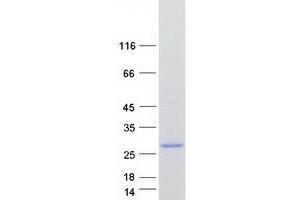 Validation with Western Blot