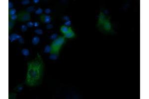 Image no. 3 for anti-Phosphoinositide-3-Kinase, Regulatory Subunit 5 (PIK3R5) antibody (ABIN1500214) (PIK3R5 Antikörper)