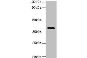 Western blot All lanes: PRPSAP1 antibody at 4 μg/mL + Hela whole cell lysate Secondary Goat polyclonal to rabbit IgG at 1/10000 dilution Predicted band size: 40, 43 kDa Observed band size: 40 kDa (PRPSAP1 Antikörper  (AA 1-240))