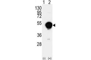 Western Blotting (WB) image for anti-Cytochrome P450, Family 20, Subfamily A, Polypeptide 1 (CYP20A1) antibody (ABIN3003220) (CYP20A1 Antikörper)
