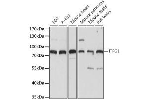 Western blot analysis of extracts of various cell lines, using ITFG1 antibody (ABIN7267919) at 1:1000 dilution. (ITFG1 Antikörper  (AA 313-612))
