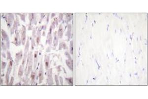 Immunohistochemistry analysis of paraffin-embedded human heart, using PPAR-BP (Phospho-Thr1457) Antibody. (PPAR-BP (AA 1423-1472), (pThr1457) Antikörper)