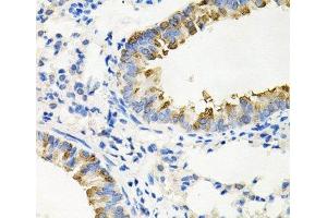 Immunohistochemistry of paraffin-embedded Mouse lung using IRAK2 Polyclonal Antibody at dilution of 1:100 (40x lens).