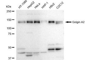 Western blotting analysis using Golgin A2 antibody (ABIN7798797). (Rekombinanter Golgin A2 (GOLGA2) Antikörper)