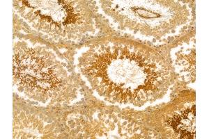 ABIN6259962 and ABIN6273032 at 1/100 staining Rat testis tissue by IHC-P.
