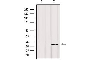 Western blot analysis of extracts from Hela, using BIK Antibody.