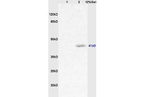 Lane 1: rat lung lysates Lane 2: human colon carcinoma lysates probed with Anti CD64/IGFR1/FCGR1A Polyclonal Antibody, Unconjugated (ABIN747413) at 1:200 in 4 °C. (FCGR1A Antikörper  (AA 101-200))
