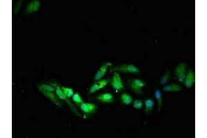 Immunofluorescent analysis of HepG2 cells using ABIN7171009 at dilution of 1:100 and Alexa Fluor 488-congugated AffiniPure Goat Anti-Rabbit IgG(H+L) (SOCS7 Antikörper  (AA 6-165))