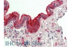 IHC-P analysis of Human Lung Tissue, with HE staining. (SCGB1A1 Antikörper  (AA 23-91))