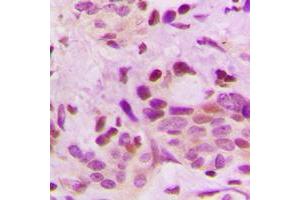 Immunohistochemistry (IHC) image for anti-Heterogeneous Nuclear Ribonucleoprotein D (HNRNPD) (Center) antibody (ABIN7300834)