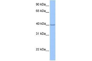 ZNF385D antibody used at 0. (ZNF385D Antikörper  (N-Term))