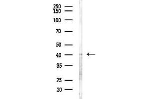 anti-GATA Binding Protein 5 (GATA5) (Internal Region) antibody