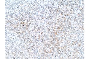 Immunohistochemistry (IHC) image for anti-CD4 (CD4) (AA 26-397) antibody (ABIN7455077)