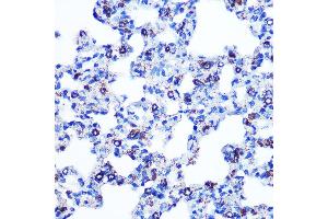 Immunohistochemistry of paraffin-embedded rat lung using Monoamine Oxidase B (MAOB) (MAOB) Rabbit mAb (ABIN7268682) at dilution of 1:100 (40x lens). (Monoamine Oxidase B Antikörper)