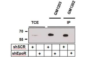 Immunoprecipitation of EpoR with and from A549 lung carcinoma cells expressing control (shSCR) and three EpoR-specific small hairpin RNAs (shEpoR). (EPOR Antikörper)