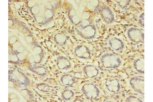 Immunohistochemistry of paraffin-embedded human small intestine tissue using ABIN7172654 at dilution of 1:100 (SPIC Antikörper  (AA 1-248))