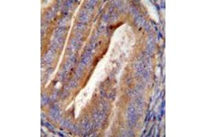 Immunohistochemistry analysis in formalin fixed and paraffin embedded human uterus tissue reacted with OGN Antibody (C-term)  followed by peroxidase conjugation of the secondary antibody and DAB staining.