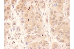 anti-Ubiquitin Specific Peptidase 8 (USP8) (AA 400-450) antibody