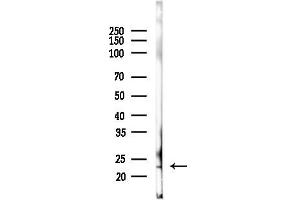 anti-Breast Carcinoma Amplified Sequence 4 (BCAS4) (Internal Region) antibody