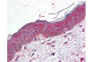 Immunohistochemistry (Formalin/PFA-fixed paraffin-embedded sections) of human skin with TSPAN6 polyclonal antibody .