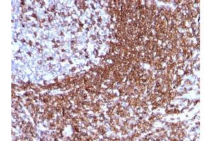 Formalin-fixed, paraffin-embedded human Tonsil stained with CD50 Mouse Monoclonal Antibody (186-2G9). (ICAM-3/CD50 Antikörper)