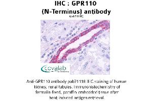 Image no. 1 for anti-G Protein-Coupled Receptor 110 (GPR110) (Extracellular Domain), (N-Term) antibody (ABIN1734904)
