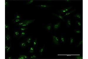 Immunofluorescence of purified MaxPab antibody to TSPYL6 on HeLa cell. (TSPY-Like 6 Antikörper  (AA 1-410))
