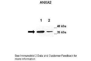 Lanes:   Lane 1: 20ug mouse GL261 cell lysate Lane 2: 20ug mouse astrocyte cell lysate  Primary Antibody Dilution:   1:250  Secondary Antibody:   Anti-rabbit-HRP  Secondary Antibody Dilution:   1:500  Gene Name:   ANXA2  Submitted by:   Anonymous (Annexin A2 Antikörper  (C-Term))