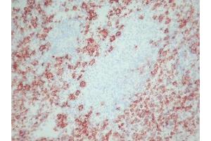 Immunohistochemistry (IHC) image for anti-Macrophages antibody (ABIN781726) (Macrophages Antikörper)