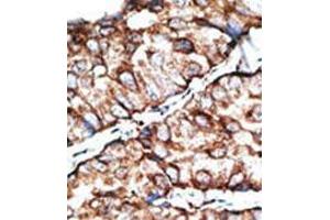 Image no. 2 for anti-Dickkopf-Like 1 (DKKL1) (C-Term) antibody (ABIN357076) (Dickkopf-Like 1 (DKKL1) (C-Term) Antikörper)