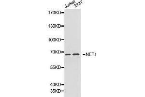 Western blot analysis of Jurkat cell and 293T cell lysate using NET1 antibody.