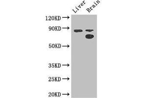 Western Blot Positive WB detected in: Mouse liver tissue, Mouse brain tissue All lanes: SMURF1 antibody at 3. (SMURF1 Antikörper  (AA 198-374))