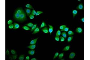 Immunofluorescence staining of Hela cells with ABIN7167118 at 1:133, counter-stained with DAPI. (RIN3 Antikörper  (AA 245-465))