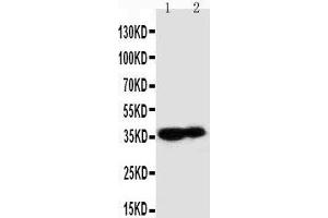 Anti-Kallikrein 9 antibody, Western blotting Lane 1: MCF-7 Cell Lysate Lane 2: A431 Cell Lysate