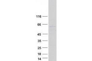 Western Blotting (WB) image for Primase, DNA, Polypeptide 2 (58kDa) (PRIM2) protein (Myc-DYKDDDDK Tag) (ABIN2719560)
