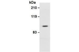 Western Blotting (WB) image for anti-Integrin beta 3 (ITGB3) antibody (ABIN1449278) (Integrin beta 3 Antikörper)