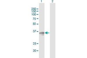 Western Blot analysis of SGCG expression in transfected 293T cell line by SGCG MaxPab polyclonal antibody. (SGCG Antikörper  (AA 1-291))