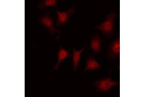 ABIN6267688 staining Hela by IF/ICC. (DOK1 Antikörper  (pTyr398))