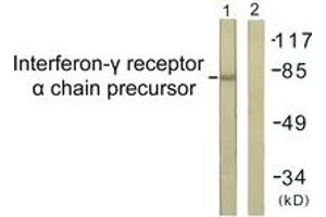 Western blot analysis of extracts from COS7 cells, using Interferon-gamma Receptor alpha chain (Ab-457) Antibody. (IFNGR1 Antikörper  (AA 431-480))