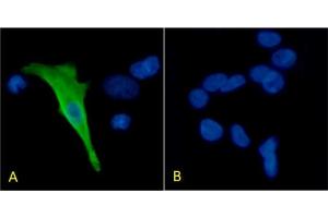 Immunofluorescence staining of HEK293 cells with Anti-Protein C (ABIN7487753) HPC-4 Immunofluorescence analysis of paraformaldehyde fixed HEK293 cells transfected with Protein C expressing plasmid (A) and non-transfected HEK293 cells (B), permeabilized with 0. (Rekombinanter PROC Antikörper)