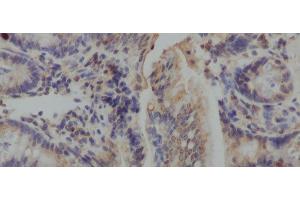 Immunohistochemistry of paraffin-embedded Mouse colon using IL10 Polyclonal Antibody at dilution of 1:50 (IL-10 Antikörper)