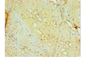Immunohistochemistry of paraffin-embedded human small intestine tissue using ABIN7143885 at dilution of 1:100 (aHSP Antikörper  (AA 1-102))