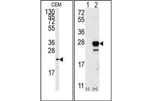 Image no. 1 for anti-GTPase NRas (NRAS) (N-Term) antibody (ABIN360038)
