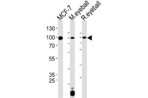 Western Blotting (WB) image for anti-Collagen, Type IX, alpha 1 (COL9A1) antibody (ABIN3001615) (COL9A1 Antikörper)
