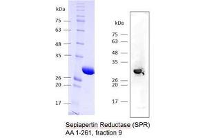 Image no. 2 for Sepiapterin Reductase (SPR) (AA 1-261) protein (Strep Tag) (ABIN3077209)