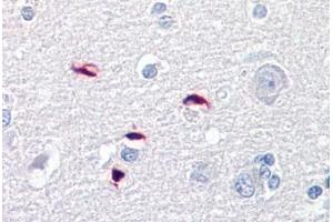 Anti-GLI1 antibody IHC staining of human brain, cortex. (GLI1 Antikörper  (AA 940-990))