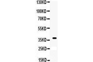 Anti-XRCC3 antibody, Western blotting All lanes: Anti XRCC3 at 0. (XRCC3 Antikörper  (C-Term))