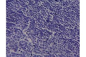 Immunohistochemistry (IHC) image for anti-Cytochrome P450, Family 1, Subfamily A, Polypeptide 1 (CYP1A1) (Internal Region) antibody (ABIN870663)